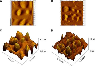 Characteristics of enzymolysis of silkworm pupa protein after tri-frequency ultrasonic pretreatment: kinetics, thermodynamics, structure and antioxidant changes